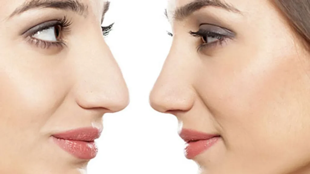 The nose is like a radar: Similes for Nose